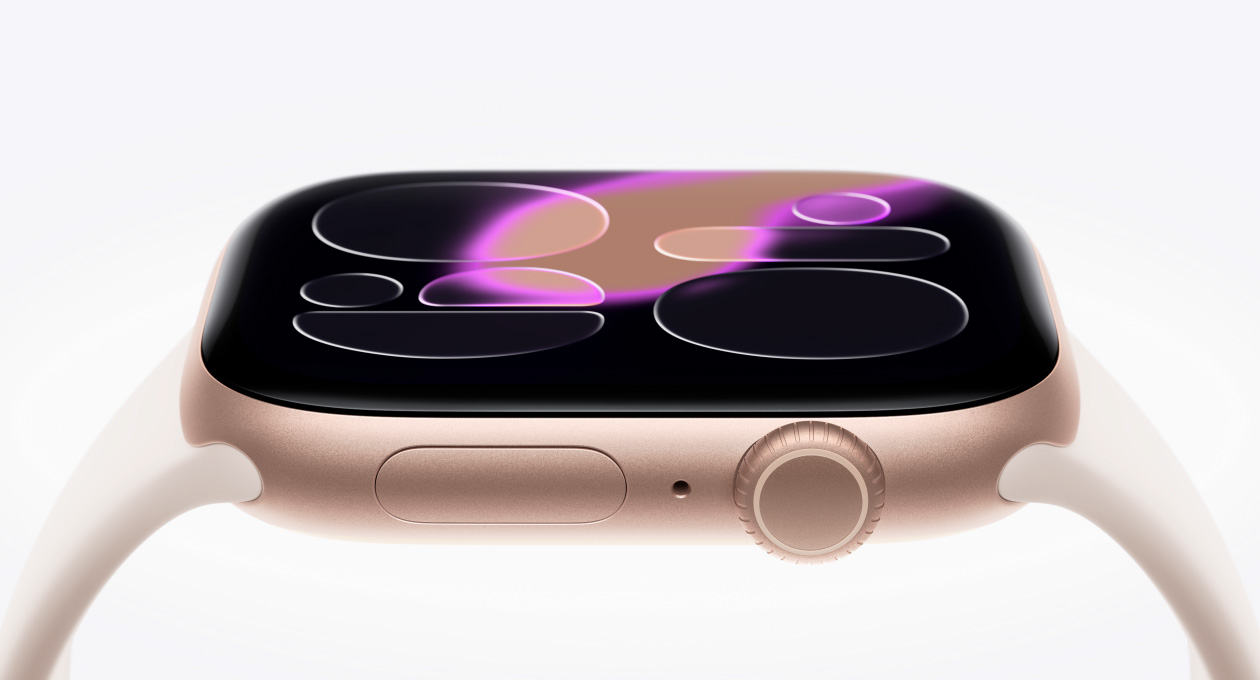 Apple Watch Series 11, ružičasta zlatna boja, aluminijsko kućište, brojčanik Responsive Art, vanjska desna strana, Digital Crown, mikrofon, bočna tipka, sportska narukvica, boja rumena